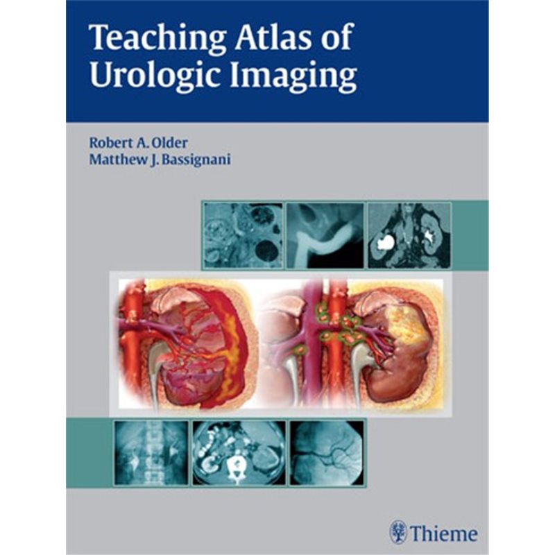 Teaching Atlas of Urologic Imaging